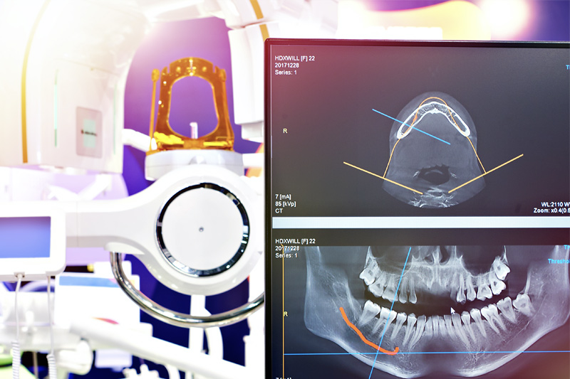 Digital X-Rays in Berkeley