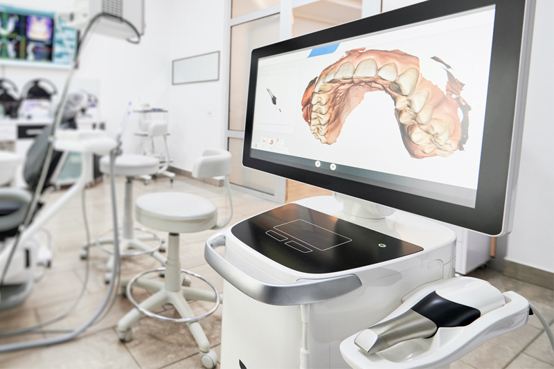 Intra-Oral Scanner in Berkeley